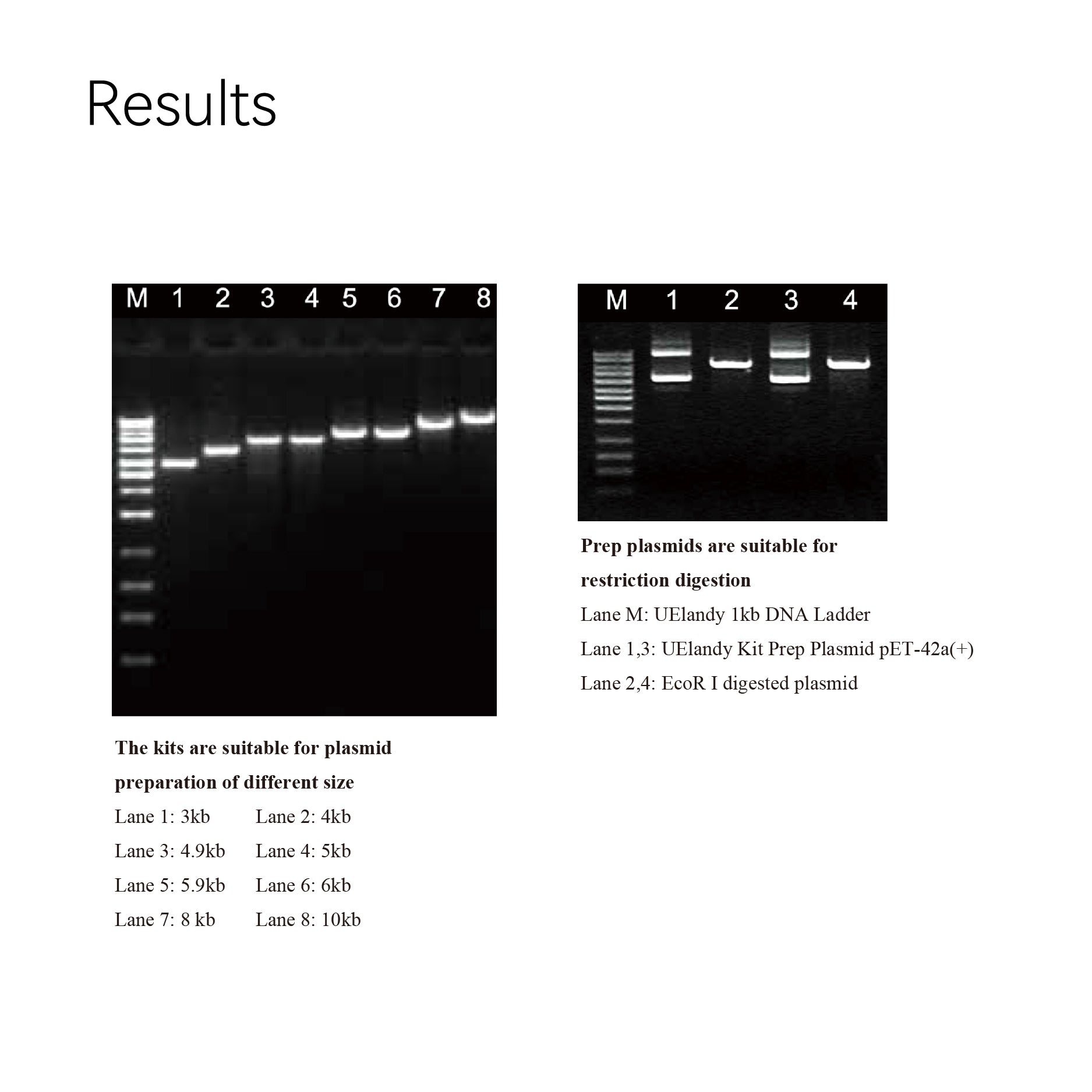 UElandy Plasmid Miniprep Kit for Rapid Plasmid DNA Purification, 10 Preps